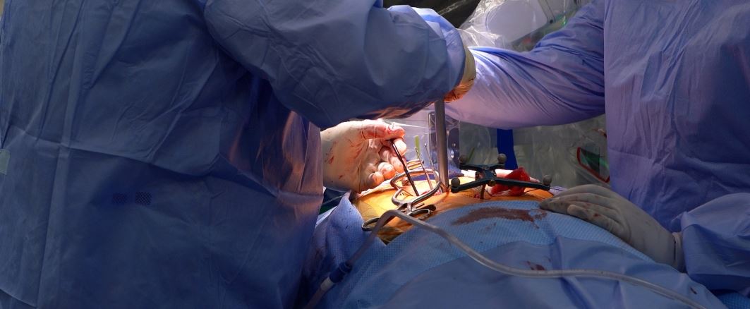 Dr. Stephen Eichert 150th robotic spine surgery